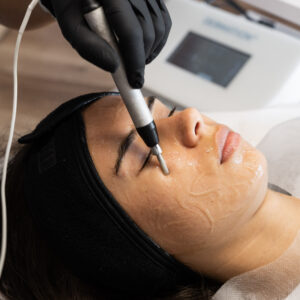 Derma Active Treatment ⭢ Mezoterapia bezigłowa